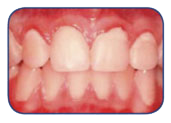 periodontal